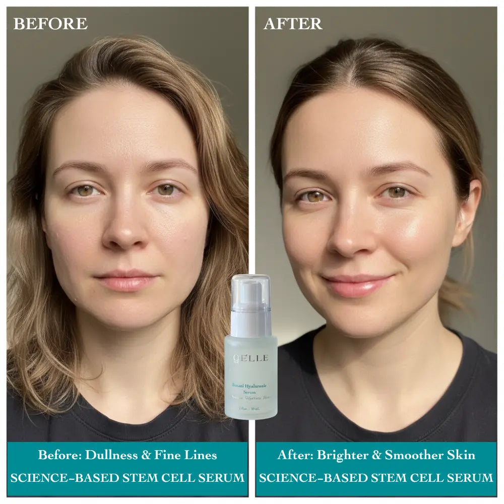 Botani Hyaluronic Serum (Plant Stem Cell Serum)